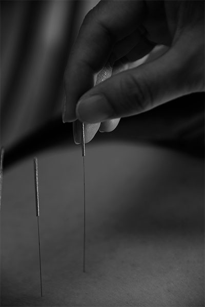 “01-018+行針”為智能對象-1.jpg